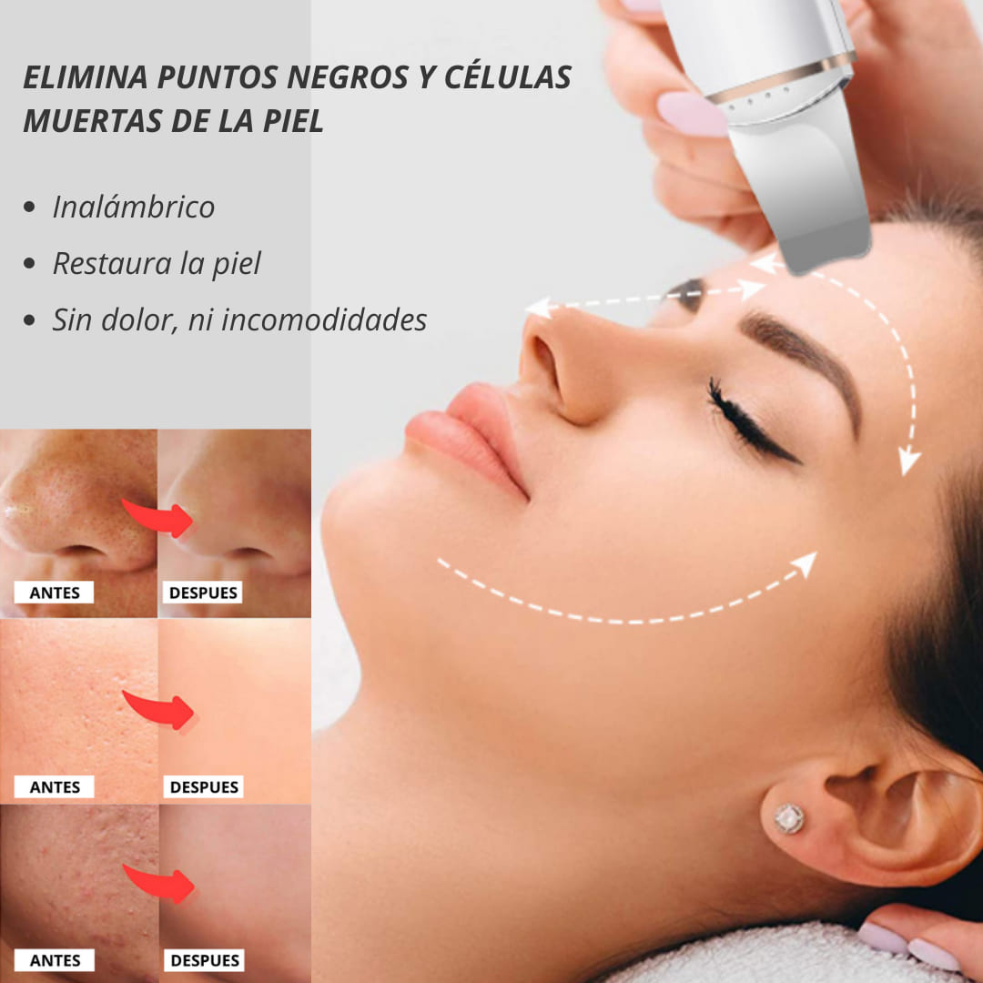 Limpiador facial inalámbrico para remover puntos negros